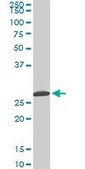 Monoclonal Anti-MTAP antibody produced in mouse clone 2G4, purified immunoglobulin, buffered aqueous solution