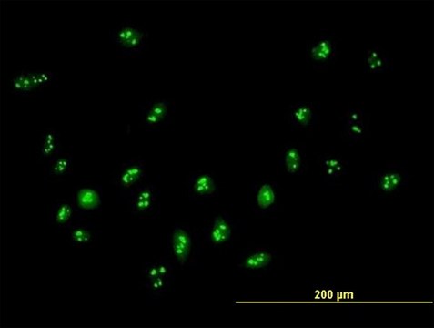 Anti-DDX18 antibody produced in mouse purified immunoglobulin, buffered aqueous solution