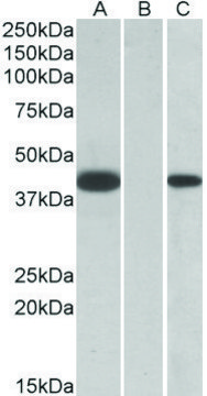 Anti-FANCF antibody produced in goat affinity isolated antibody, buffered aqueous solution