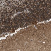Anti-CACNB4 antibody produced in rabbit Prestige Antibodies&#174; Powered by Atlas Antibodies, affinity isolated antibody, buffered aqueous glycerol solution
