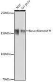 Anti-Neurofilament M Antibody, clone 5E0D2, Rabbit Monoclonal