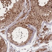 Anti-PSMA1 antibody produced in rabbit Prestige Antibodies&#174; Powered by Atlas Antibodies, affinity isolated antibody, buffered aqueous glycerol solution