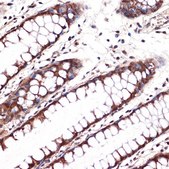 Anti-Carbonic Anhydrase 1 (CA2) antibody produced in rabbit