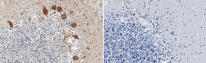 Anti-Maxi K/BK channel Antibody, clone 3D15 ZooMAb&#174; Rabbit Monoclonal recombinant, expressed in HEK 293 cells