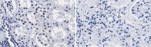 Anti-PARP-1 Antibody, clone 12N17 Antibody, ZooMAb&#174; Rabbit Monoclonal recombinant, expressed in HEK 293 cells