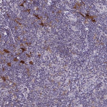 Anti-SNX11 antibody produced in rabbit Prestige Antibodies&#174; Powered by Atlas Antibodies, affinity isolated antibody, buffered aqueous glycerol solution