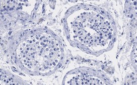Anti-UBR5 Antibody, clone 2F14 ZooMAb&#174; Rabbit Monoclonal recombinant, expressed in HEK 293 cells