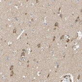 Anti-DKK3 antibody produced in rabbit Prestige Antibodies&#174; Powered by Atlas Antibodies, affinity isolated antibody, buffered aqueous glycerol solution