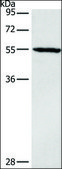 Anti-DGAT1 antibody produced in rabbit affinity isolated antibody