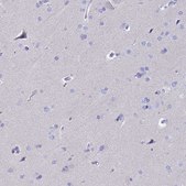 Anti-RNASE2 antibody produced in rabbit Prestige Antibodies&#174; Powered by Atlas Antibodies, affinity isolated antibody, buffered aqueous glycerol solution