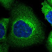 Anti-SLC39A14 antibody produced in rabbit Prestige Antibodies&#174; Powered by Atlas Antibodies, affinity isolated antibody, buffered aqueous glycerol solution