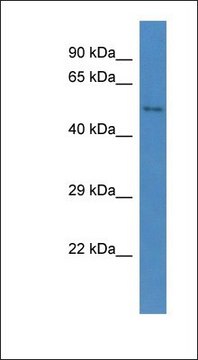 Anti-CCBE1 antibody produced in rabbit affinity isolated antibody