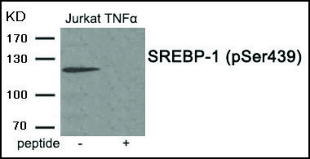 Anti-phospho-SREBP-1 (pSer439) antibody produced in rabbit affinity isolated antibody