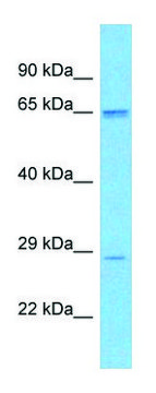 Anti-SCD5 antibody produced in rabbit affinity isolated antibody
