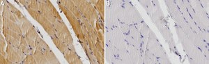 Anti-CHRNA1/ACHRA Antibody, clone 2G22 ZooMAb&#174; Rabbit Monoclonal recombinant, expressed in HEK 293 cells