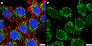 Anti-S100A12 Antibody, clone 1L6 ZooMAb&#174; Rabbit Monoclonal recombinant, expressed in HEK 293 cells