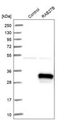 Anti-RAB27B antibody produced in rabbit Prestige Antibodies&#174; Powered by Atlas Antibodies, affinity isolated antibody, buffered aqueous glycerol solution