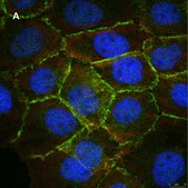 Anti-beta Catenin Antibody, clone 3J7, ZooMAb&#174; Rabbit Monoclonal recombinant, expressed in HEK 293 cells
