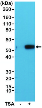 Anti-Acetyl-alpha-Tubulin (Lys40) antibody, Rabbit monoclonal recombinant, expressed in HEK 293 cells, clone RM318, purified immunoglobulin