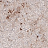 Monoclonal Anti-SAA1 antibody produced in mouse Prestige Antibodies&#174; Powered by Atlas Antibodies, clone CL9175, purified immunoglobulin, buffered aqueous glycerol solution