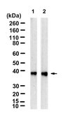 Anti-PSAT1 Antibody, clone 1C7 ZooMAb&#174; Rabbit Monoclonal recombinant, expressed in HEK 293 cells