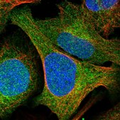 Anti-GCLM antibody produced in rabbit affinity isolated antibody, buffered aqueous glycerol solution
