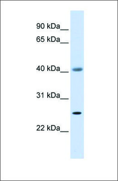 Anti-ADA antibody produced in rabbit affinity isolated antibody