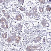 Anti-ATP6V1B1 antibody produced in rabbit Prestige Antibodies&#174; Powered by Atlas Antibodies, affinity isolated antibody, buffered aqueous glycerol solution