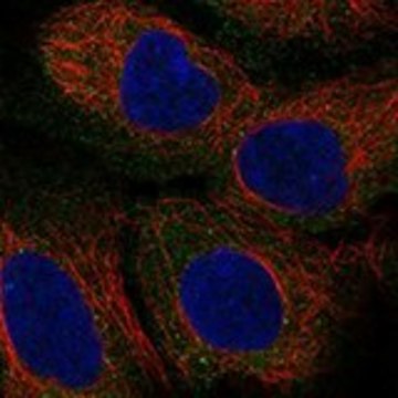 Anti-TRO antibody produced in rabbit Prestige Antibodies&#174; Powered by Atlas Antibodies, affinity isolated antibody, buffered aqueous glycerol solution