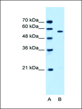 Anti-STK3 antibody produced in rabbit affinity isolated antibody