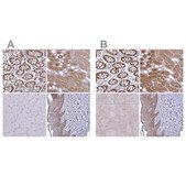 Anti-TXN antibody produced in rabbit Prestige Antibodies&#174; Powered by Atlas Antibodies, affinity isolated antibody, buffered aqueous glycerol solution