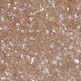 Anti-SLC17A7 antibody produced in rabbit Prestige Antibodies&#174; Powered by Atlas Antibodies, affinity isolated antibody, buffered aqueous glycerol solution