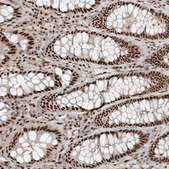 Anti-CKS2 antibody produced in rabbit Prestige Antibodies&#174; Powered by Atlas Antibodies, affinity isolated antibody, buffered aqueous glycerol solution