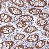 Anti-TXN antibody produced in rabbit Prestige Antibodies&#174; Powered by Atlas Antibodies, affinity isolated antibody, buffered aqueous glycerol solution
