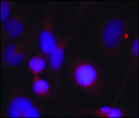 Anti-HDAC2 (Ab-394) antibody produced in rabbit affinity isolated antibody