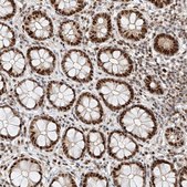 Anti-HDAC9 antibody produced in rabbit Prestige Antibodies&#174; Powered by Atlas Antibodies, affinity isolated antibody, buffered aqueous glycerol solution