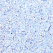 Anti-Na+/K+-ATPase antibody produced in rabbit