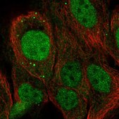 Anti-NET1 antibody produced in rabbit Prestige Antibodies&#174; Powered by Atlas Antibodies, affinity isolated antibody, buffered aqueous glycerol solution