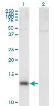 Anti-NPHP1 antibody produced in mouse purified immunoglobulin, buffered aqueous solution