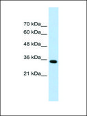 Anti-ADAMTS4 affinity isolated antibody