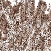 Monoclonal Anti-PIK3CB antibody produced in mouse Prestige Antibodies&#174; Powered by Atlas Antibodies, clone CL9518, purified immunoglobulin, buffered aqueous glycerol solution
