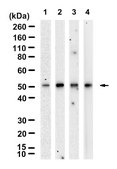 Anti-PAH Antibody, clone 1L14 ZooMAb&#174; Rabbit Monoclonal recombinant, expressed in HEK 293 cells