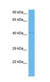 Anti-IHH antibody produced in rabbit IgG fraction of antiserum