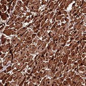 Anti-APPL2 antibody produced in rabbit Prestige Antibodies&#174; Powered by Atlas Antibodies, affinity isolated antibody, buffered aqueous glycerol solution