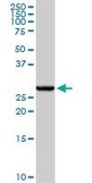 Anti-GSTA4 antibody produced in rabbit purified immunoglobulin, buffered aqueous solution