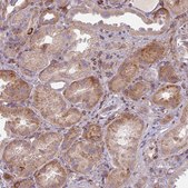 Anti-GABARAPL1 antibody produced in rabbit Prestige Antibodies&#174; Powered by Atlas Antibodies, affinity isolated antibody, buffered aqueous glycerol solution