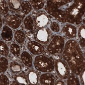 Monoclonal Anti-CARS antibody produced in mouse Prestige Antibodies&#174; Powered by Atlas Antibodies, clone CL2310, purified immunoglobulin, buffered aqueous glycerol solution
