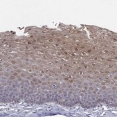 Anti-PADI1 antibody produced in rabbit Prestige Antibodies&#174; Powered by Atlas Antibodies, affinity isolated antibody, buffered aqueous glycerol solution
