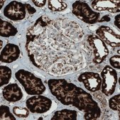 Monoclonal Anti-SDHB antibody produced in mouse Prestige Antibodies&#174; Powered by Atlas Antibodies, clone CL0349, purified immunoglobulin, buffered aqueous glycerol solution