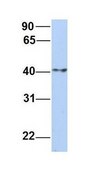 Anti-ERLIN1 antibody produced in rabbit affinity isolated antibody